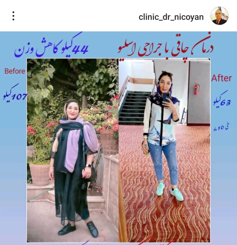 Screenshot_۲۰۲۳-۰۷-۰۶-۰۱-۴۹-۵۵-۶۶۷-edit_com.instagram.android